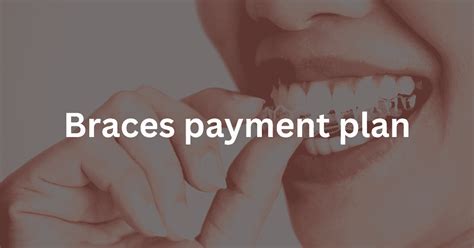 Braces payment plan. Things To Know About Braces payment plan. 